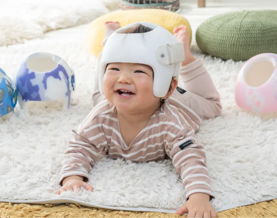 ヘルメット治療をしている赤ちゃんの写真