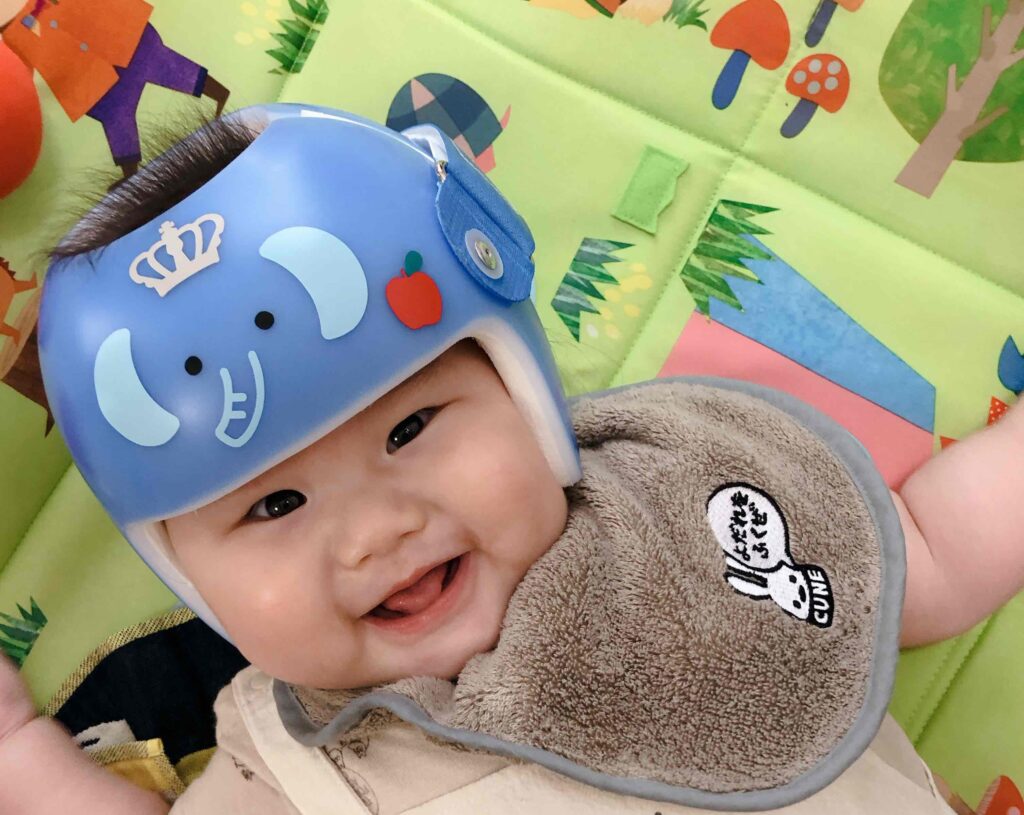 星の子だより 赤ちゃんの頭の矯正ヘルメットならスターバンド Ahs Japan Corporation 星の子だより 赤ちゃんの頭の矯正ヘルメットならスターバンド Ahs Japan Corporation