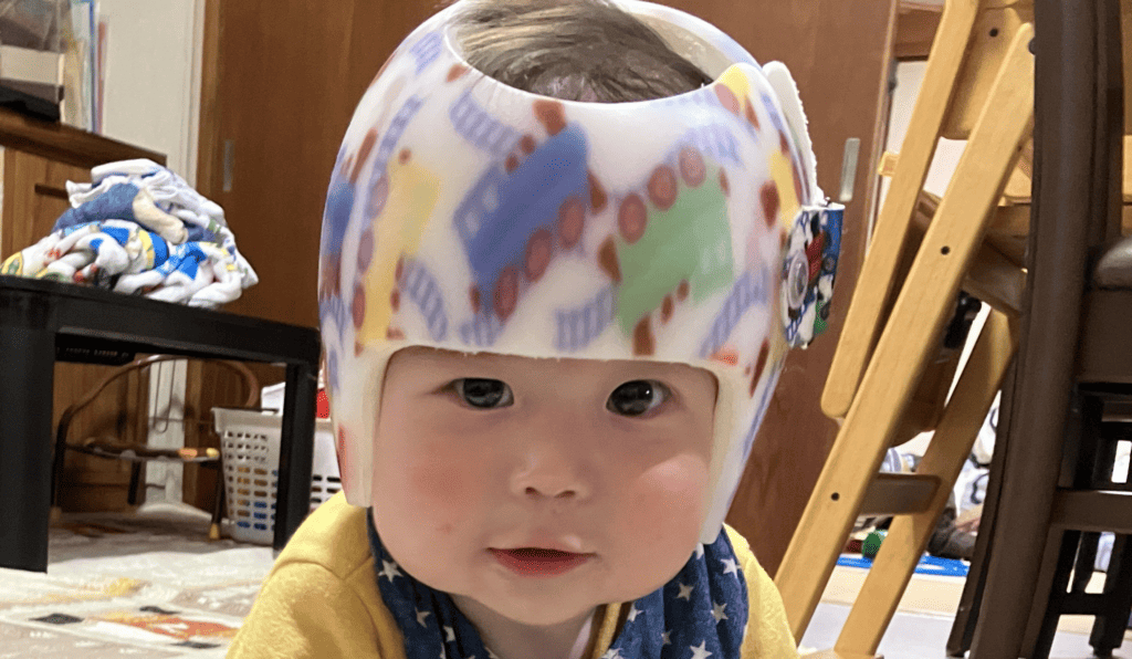 星の子体験談に新しいお便りが届きました‼：Sくん（斜頭）