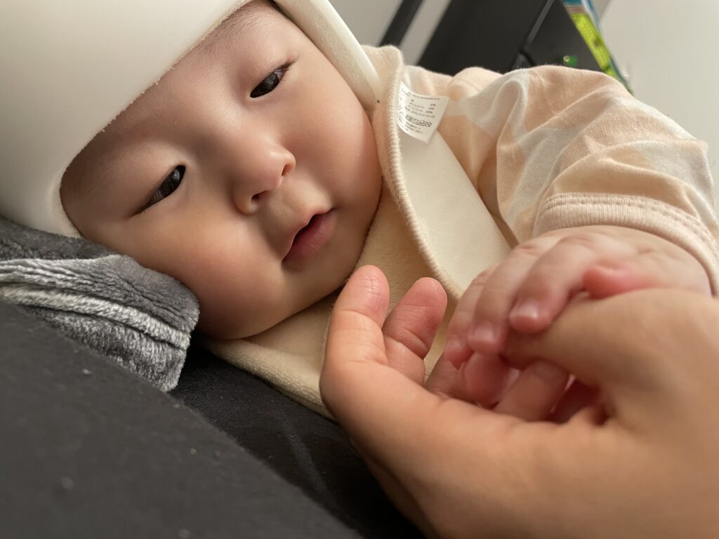 星の子体験談に新しいお便りが届きました‼：Nちゃん（短頭 斜頭）